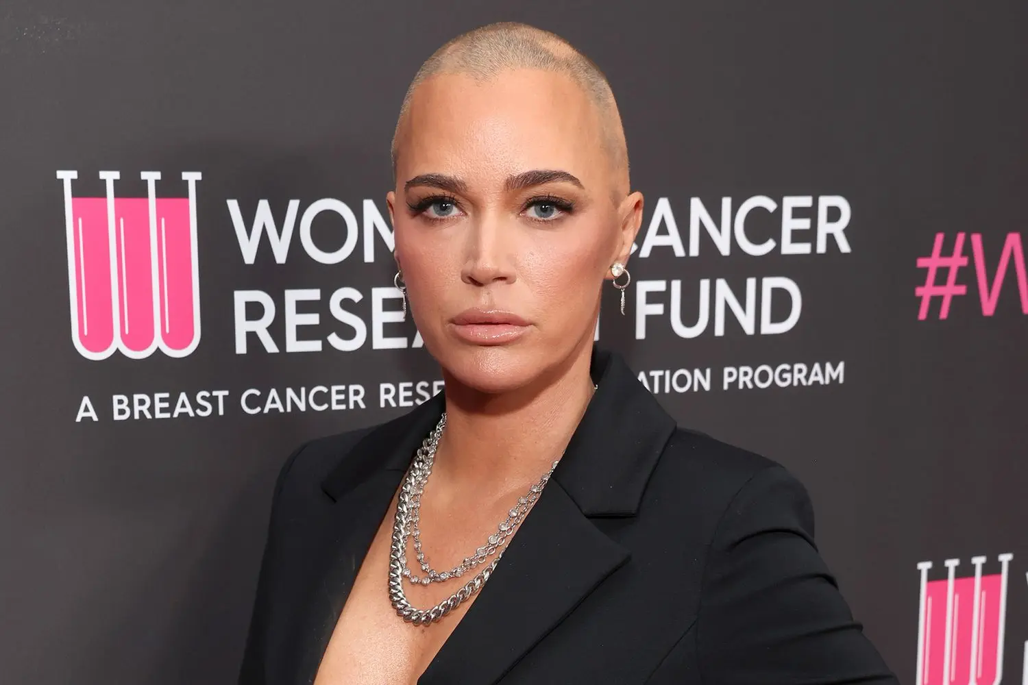 Descubre cómo Teddi Mellencamp enfrenta un nuevo reto en su lucha contra el cáncer- Últimas noticias Ecuador